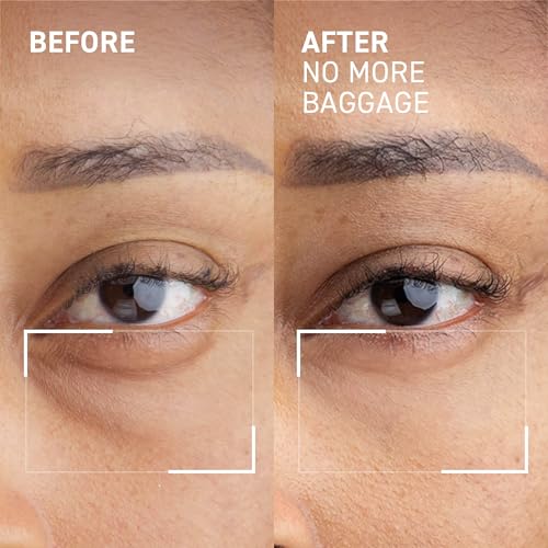 Dr. Brandt Needles No More, No More Baggage (Jumbo Size - 1 oz) - Instant Under-Eye De-Puffer & Dark Circle Eraser