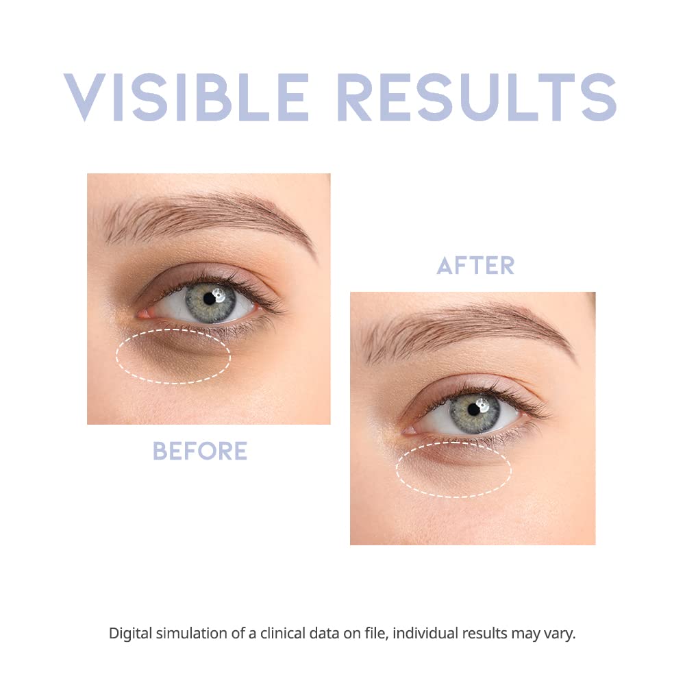 Korean Under Eye Serum with Hyaluronic Acid, Vitamin C & Caffeine (30g)