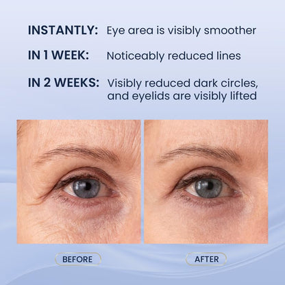 SKIN ULTIMA Dual Eye Cream - Advanced Retinol & Peptides for Dark Circles & Wrinkles (20ml)