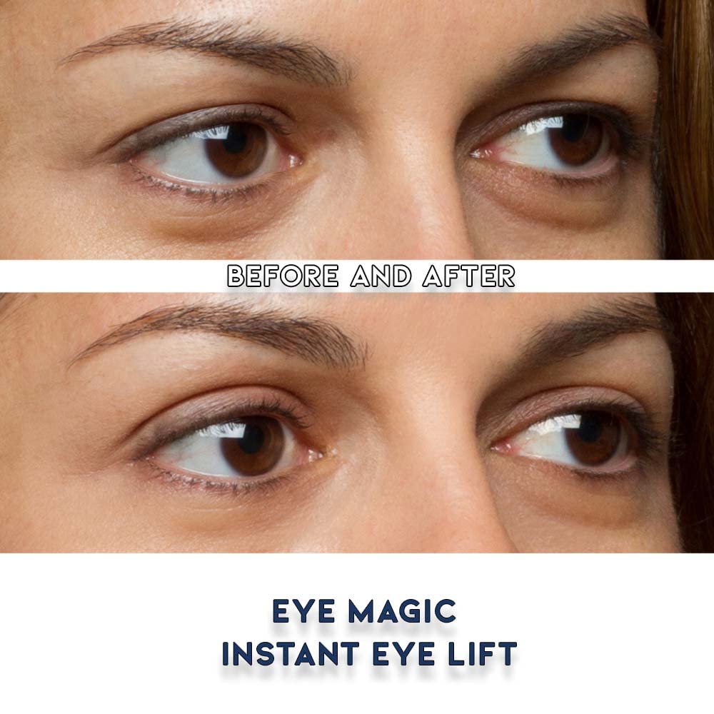 Premium Original Instant Eye Lift Kit - Eyelid Lift Strips with Wax/Gel for Droopy Upper Eyelids (64 Strips, Small/Medium)