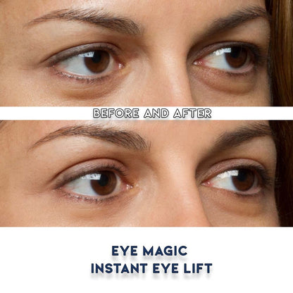 Premium Eye Lift Strips - Instant Eyelid Lift Tape for Droopy, Sagging & Hooded Eyelids, Transparent Hypoallergenic (80 Count, S/M)