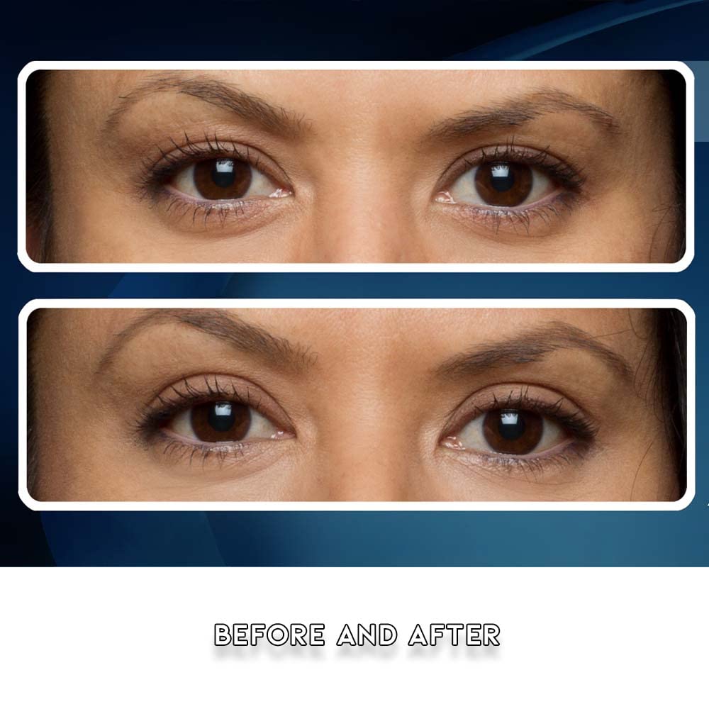 Premium Eye Lift Strips - Instant Eyelid Lift Tape for Droopy, Sagging & Hooded Eyelids, Transparent Hypoallergenic (80 Count, S/M)