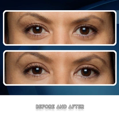 Premium Eye Lift Strips - Instant Eyelid Lift Tape for Droopy, Sagging & Hooded Eyelids, Transparent Hypoallergenic (80 Count, S/M)