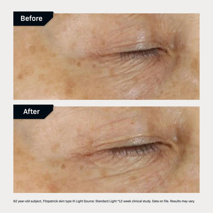 Revision Skincare D·E·J Eye Cream (0.5 fl oz) - Professional Peptide & Vitamin C Formula for 360° Eye Lifting
