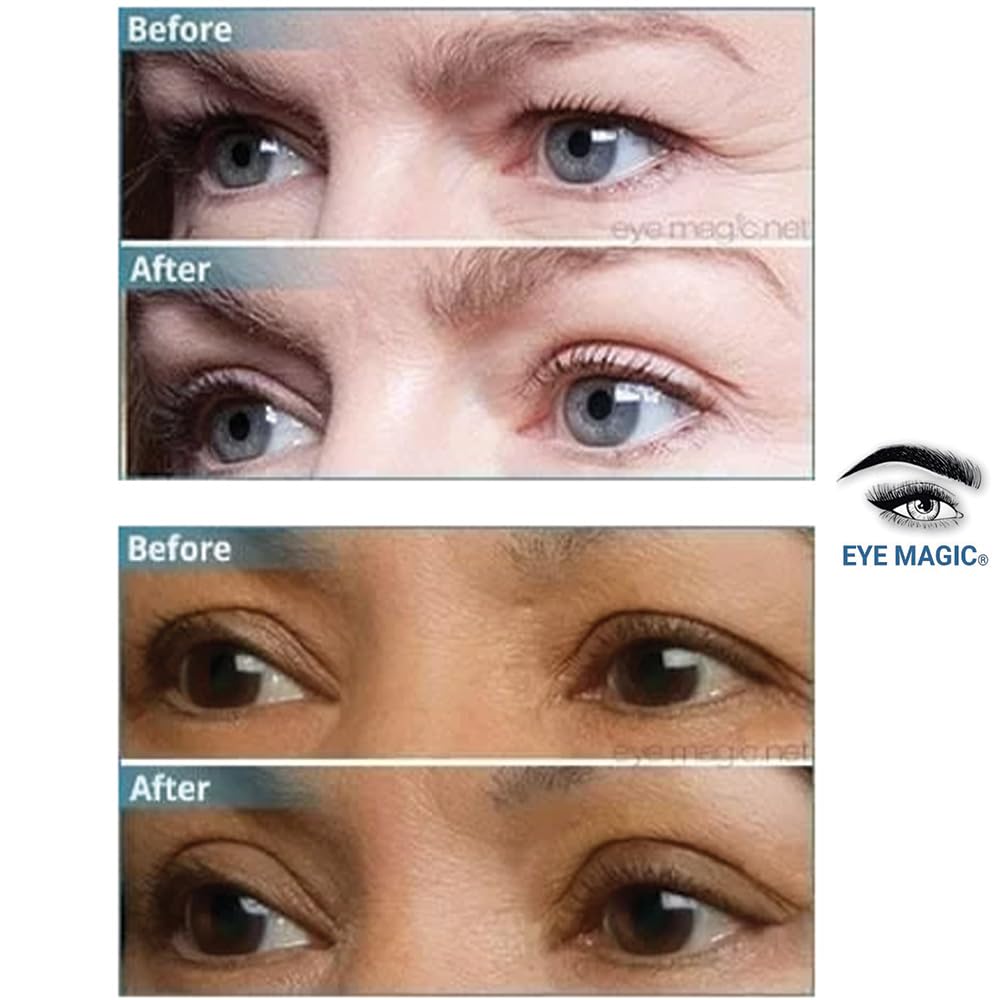 Premium Original Instant Eye Lift Kit - Eyelid Lift Strips with Wax/Gel for Droopy Upper Eyelids (64 Strips, Small/Medium)