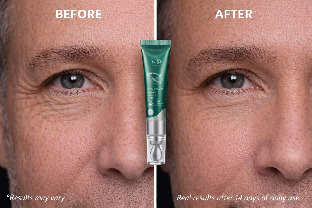 MyIDi Rejuvenating Anti-Aging Serum - 5 Peptide Lifting Fluid (15ml)