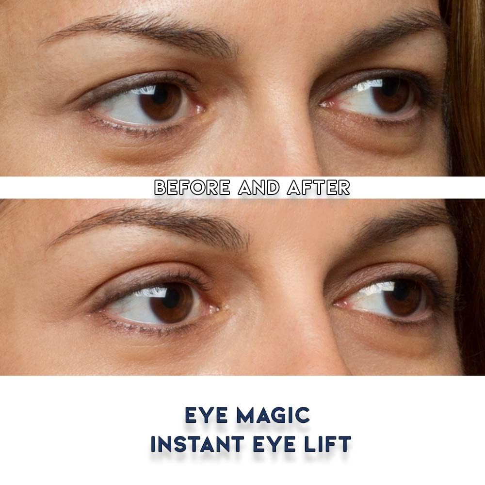 Eye Magic Premium Instant Eyelid Lift Refill (L/XL) - Invisible Eyelid Lift Strips for Droopy, Hooded Eyelids