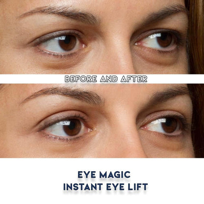 Eye Magic Premium Instant Eyelid Lift Refill (L/XL) - Invisible Eyelid Lift Strips for Droopy, Hooded Eyelids