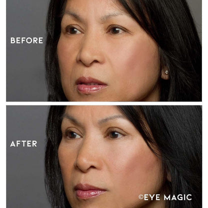 Eye Magic Premium Instant Eyelid Lift Refill (L/XL) - Invisible Eyelid Lift Strips for Droopy, Hooded Eyelids