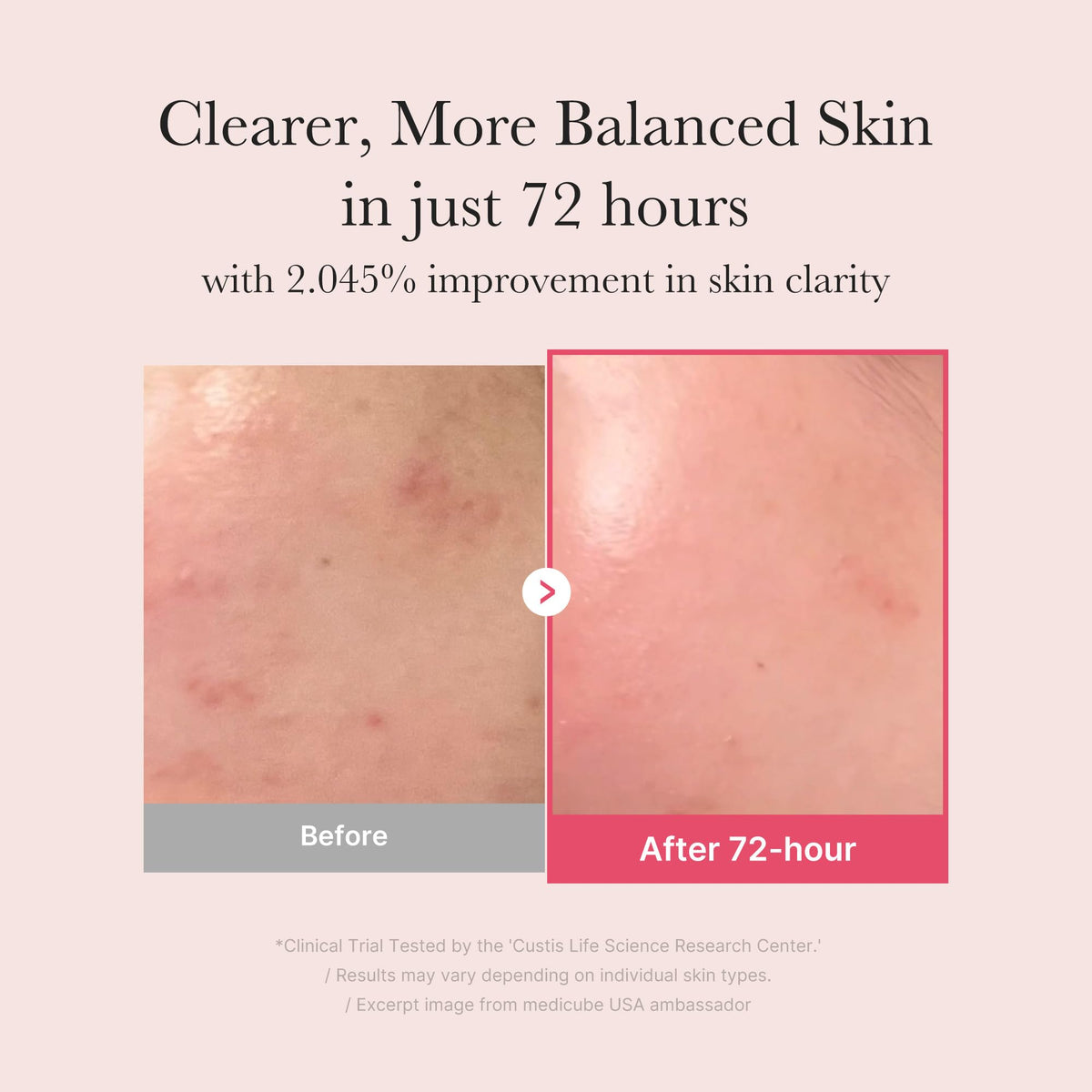 medicube TXA+Niacinamide 15% Glow Facial Serum for After Spot Care - All-in-One Daily Korean Skincare - Uneven Skin Tone, Texture, and Hydration Care - High-Potency Tranexamic Acid 5% - 1.01 fl.oz