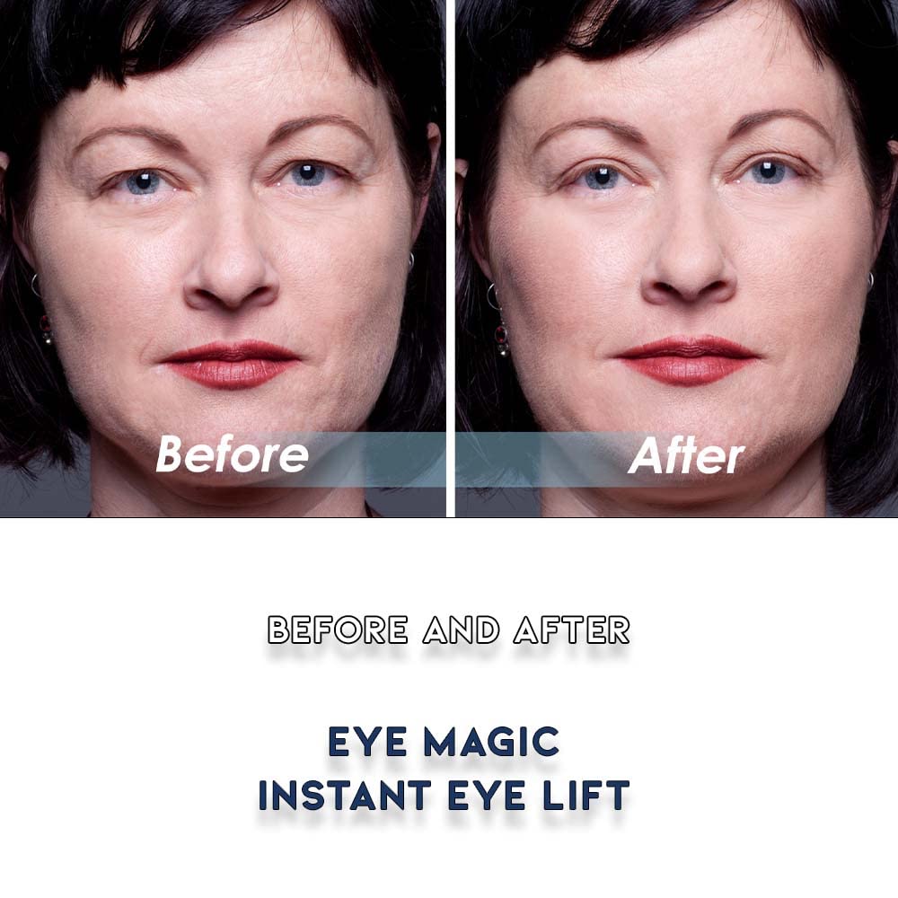 Premium Original Instant Eye Lift Kit - Eyelid Lift Strips with Wax/Gel for Droopy Upper Eyelids (64 Strips, Small/Medium)