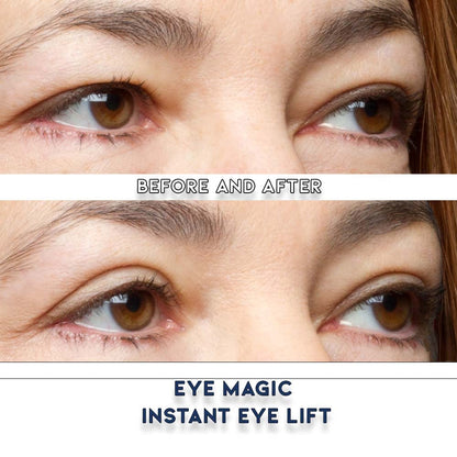 Eye Magic Premium Instant Eyelid Lift Refill (L/XL) - Invisible Eyelid Lift Strips for Droopy, Hooded Eyelids