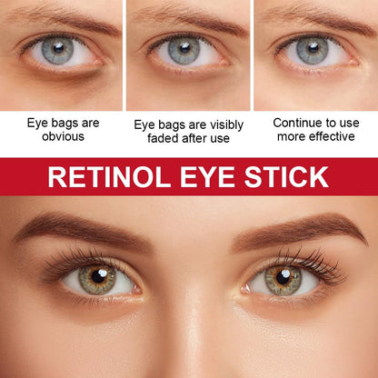 Retinol Eye Stick with Collagen & Hyaluronic Acid - Anti-Aging Eye Balm for Dark Circles, Puffiness & Wrinkles (Visible Results in 3-4 Weeks)