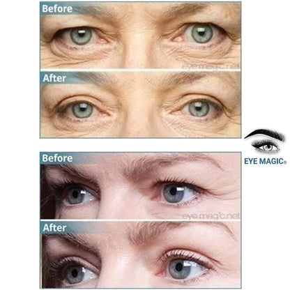 Premium Original Instant Eye Lift Kit - Eyelid Lift Strips with Wax/Gel for Droopy Upper Eyelids (64 Strips, Small/Medium)