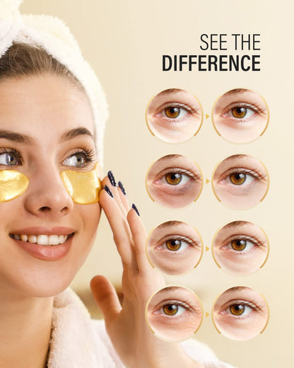 Maskiss 24k Gold Under Eye Patches (15 Pairs) - 2-Week Supply Collagen & Gold Eye Mask for Dark Circles & Puffiness