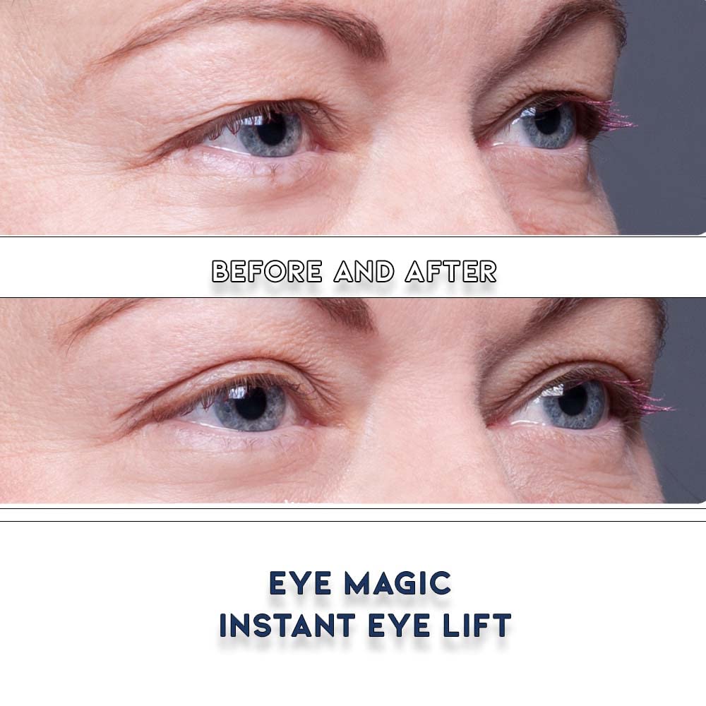 Premium Eye Lift Strips - Instant Eyelid Lift Tape for Droopy, Sagging & Hooded Eyelids, Transparent Hypoallergenic (80 Count, S/M)
