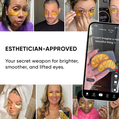 Celor Under Eye Patches (80 Pairs / 160 Patches) - Amino Acids & Collagen Eye Masks for Dark Circles, Puffiness & Wrinkles - USA Tested - Self-Care Gift for Women
