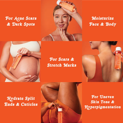Bio-Oil Skincare Body Oil Serum 6.7 oz, Face & Body Moisturizer for Scars & Stretch Marks