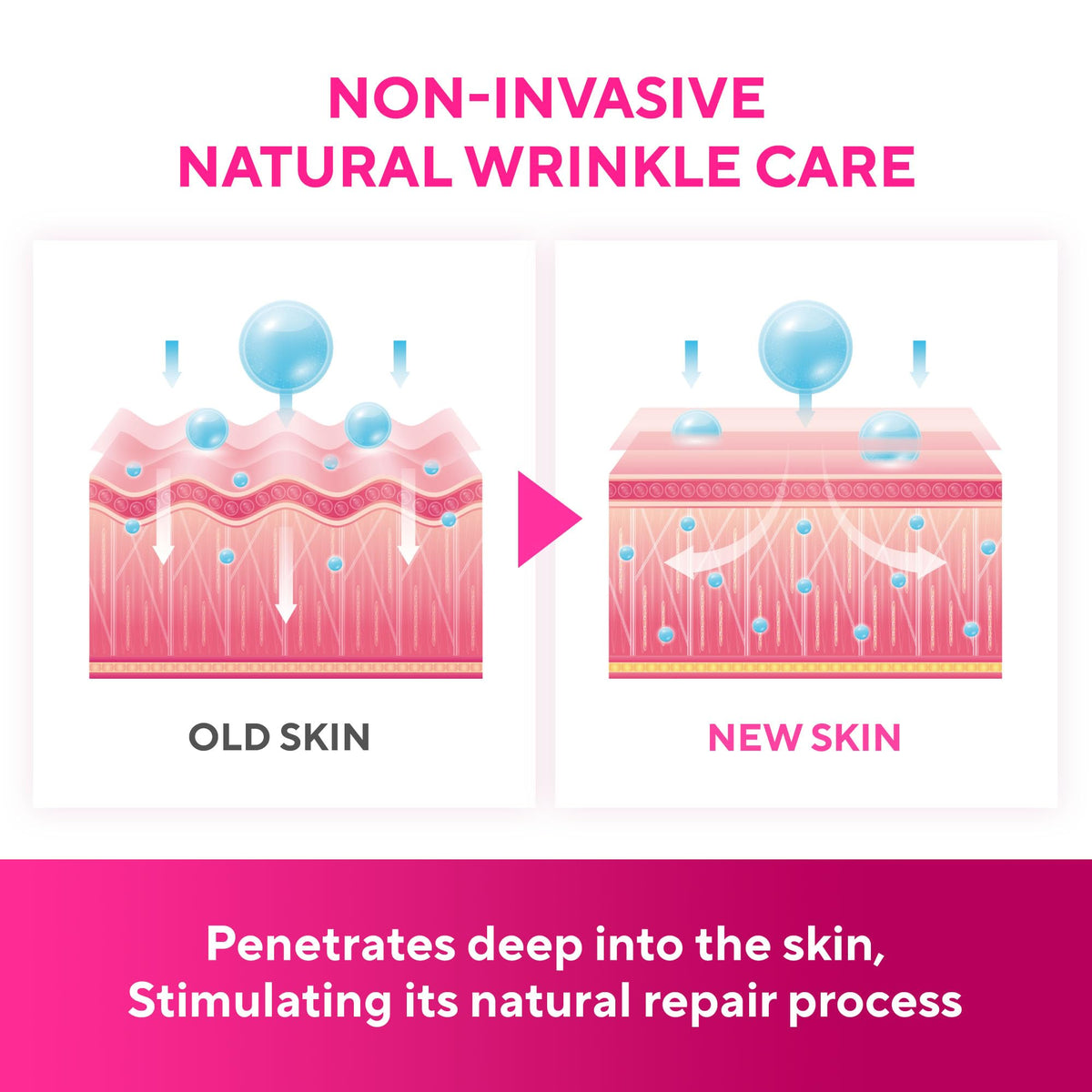 Reusable Silicone Face & Forehead Wrinkle Patches - 5 Pieces (1 Pack)