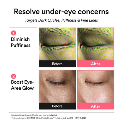 Abib PDRN Retinal Eye Patch - 60 Patches (84g) - Firming Hydrogel Masks with Niacinamide for Dark Circles & Fine Lines