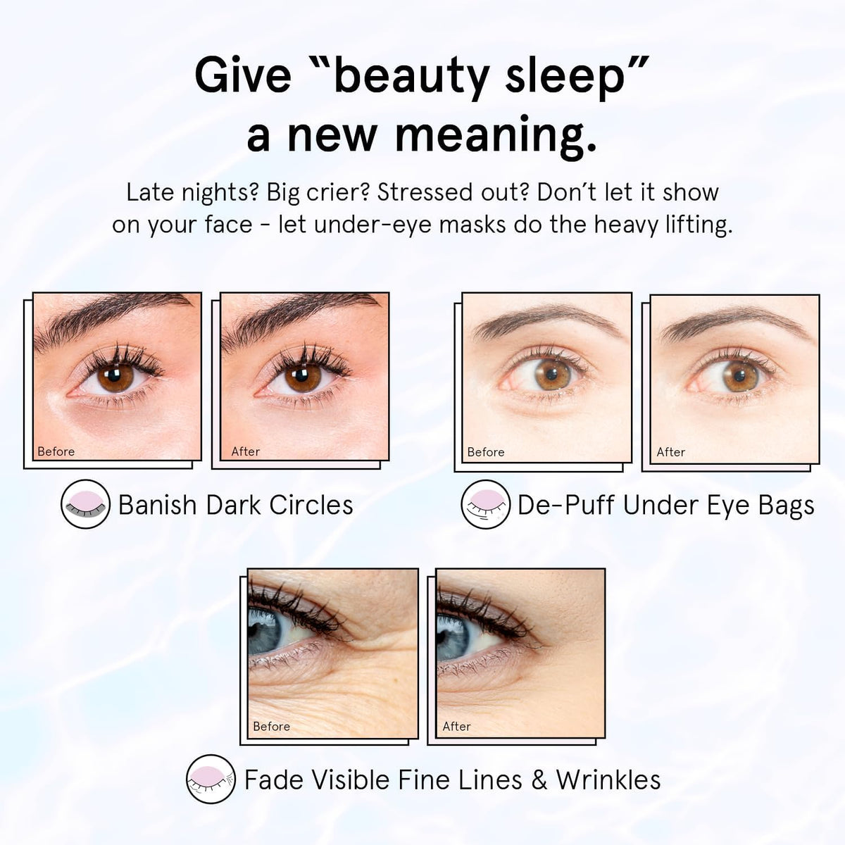 grace & stella Retinol & Purple Under Eye Patches - 6 Pairs - Restoring Gel Masks with Hyaluronic Acid