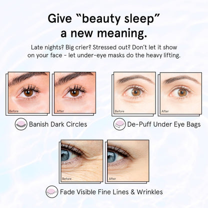 grace & stella Retinol & Purple Under Eye Patches - 6 Pairs - Restoring Gel Masks with Hyaluronic Acid