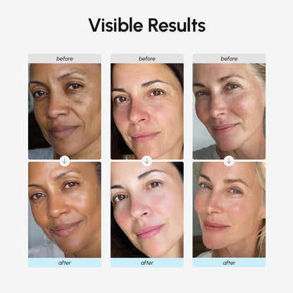 MAREE Face Moisturizer Retinol Cream for Face - Daily Wrinkle Cream for Women - Anti-Aging Face Cream - Facial Moisturizer with Collagen - Crema Hidratante Para la Cara for Skin Tightening