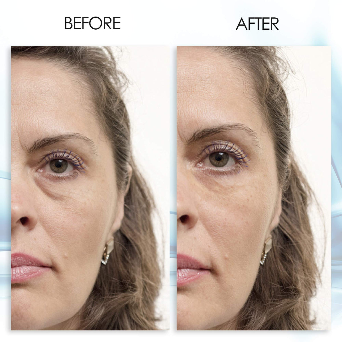 Aqua Mineral Puffy Eye Gel - 30ml (1 oz) - Instant Results Rapid Reduction Eye Gel with Green Tea Extract