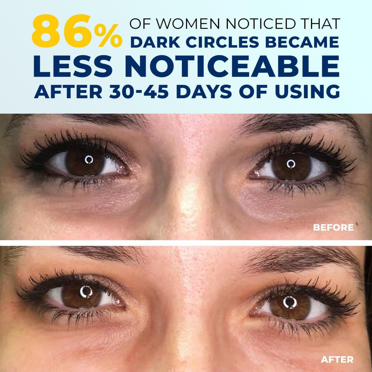 4-in-1 Under Eye Brightener - Anti-Aging Cream with 5% Caffeine, Niacinamide, Retinol & Peptides - Reduces Dark Circles, Puffiness & Wrinkles