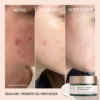 Biossance Squalane + Probiotic Balancing Face Gel Moisturizer - Advanced Formula for Oily & Acne-Prone Skin, Encapsulated Probiotics, Reduces Redness & Excess Oil, Soothes Sensitive Skin - 1.69 oz