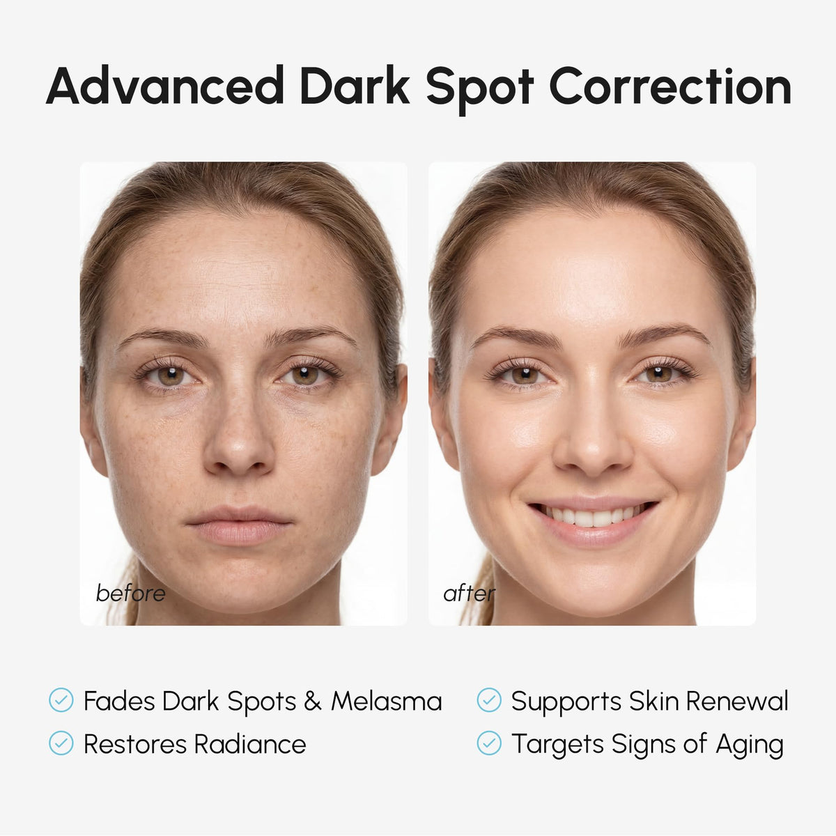 MAREE 10% Tranexamic Serum Cream - Alpha Arbutin Cream with Tranexamic Acid, Niacinamide - Dark Spot Corrector with Alfa Arbutin - Acido Tranexamico Crema para Manchas Oscuras en la Cara