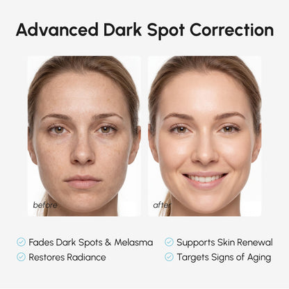 MAREE 10% Tranexamic Serum Cream - Alpha Arbutin Cream with Tranexamic Acid, Niacinamide - Dark Spot Corrector with Alfa Arbutin - Acido Tranexamico Crema para Manchas Oscuras en la Cara