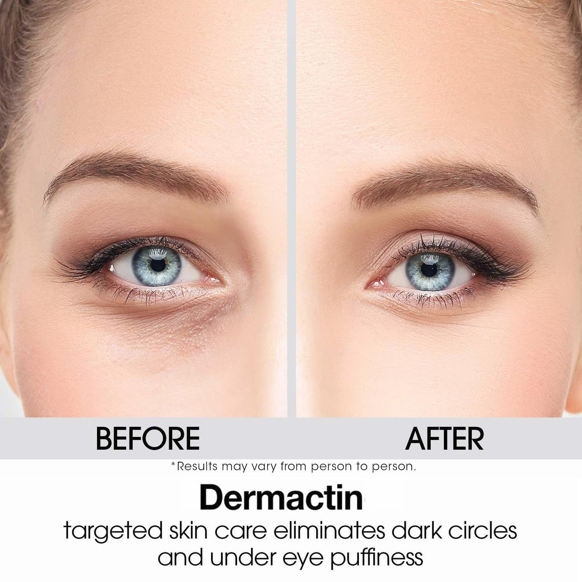 Dermactin Upper Eyelid Cream 1 oz - Firming & Toning Treatment for Sagging and Drooping Eyelids - Anti-Aging Eye Lift Cream for Sensitive Skin