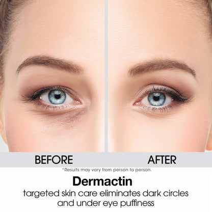 Dermactin Upper Eyelid Cream 1 oz - Firming & Toning Treatment for Sagging and Drooping Eyelids - Anti-Aging Eye Lift Cream for Sensitive Skin