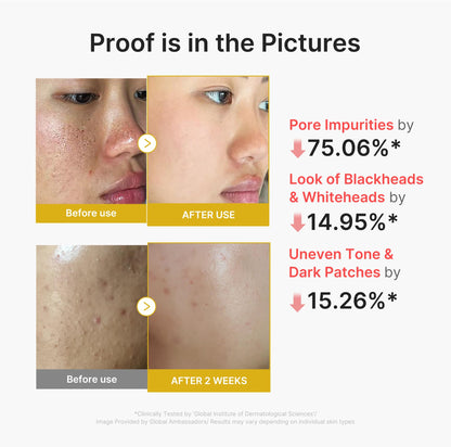 medicube Peel Shot with Kojic Acid Turmeric - Reset in One Step - Gentle Exfoliating Serum with BHA, LHA, PHA for Dead Skin Cells, Blackheads, Excess Sebum - For Dull, Rough, Troubled Skin - 2.7 fl.oz