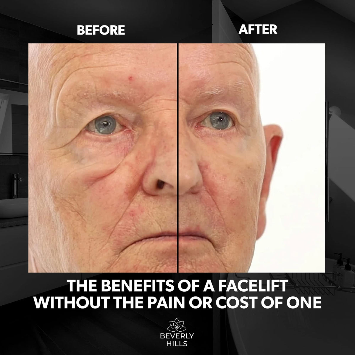 Beverly Hills Men's Instant Facelift & Eye Serum - Dark Circles, Puffy Eyes & Wrinkle Treatment