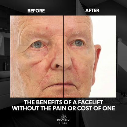 Beverly Hills Men's Instant Facelift & Eye Serum - Dark Circles, Puffy Eyes & Wrinkle Treatment