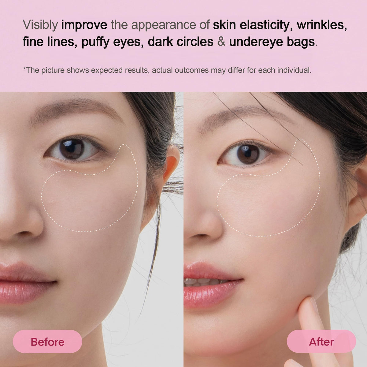 TEREZ & HONOR Peptide Collagen Under Eye Patches (60 Pcs) - Korean Firming & Anti-Aging Hydrogel Masks for Wrinkles & Bags