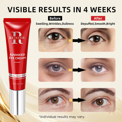 Redcool Retinol Eye Cream - Anti-Aging Eye Cream for Dark Circles, Puffiness & Wrinkles with Hyaluronic Acid & Caffeine 1.06 oz