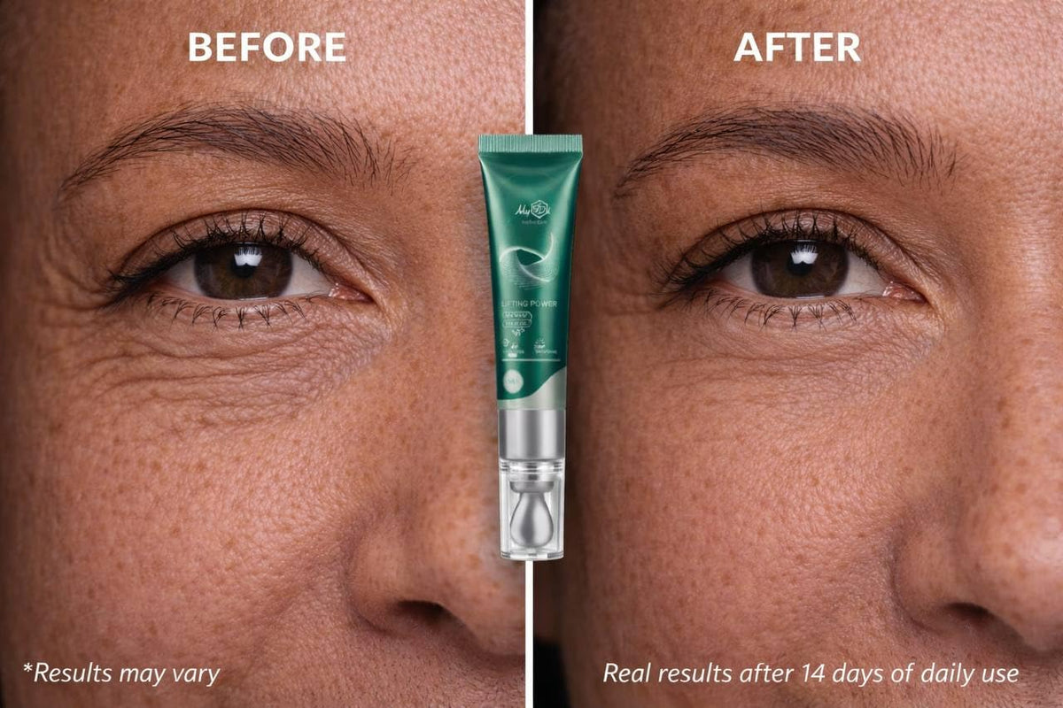 MyIDi Rejuvenating Anti-Aging Serum - 5 Peptide Lifting Fluid (15ml)
