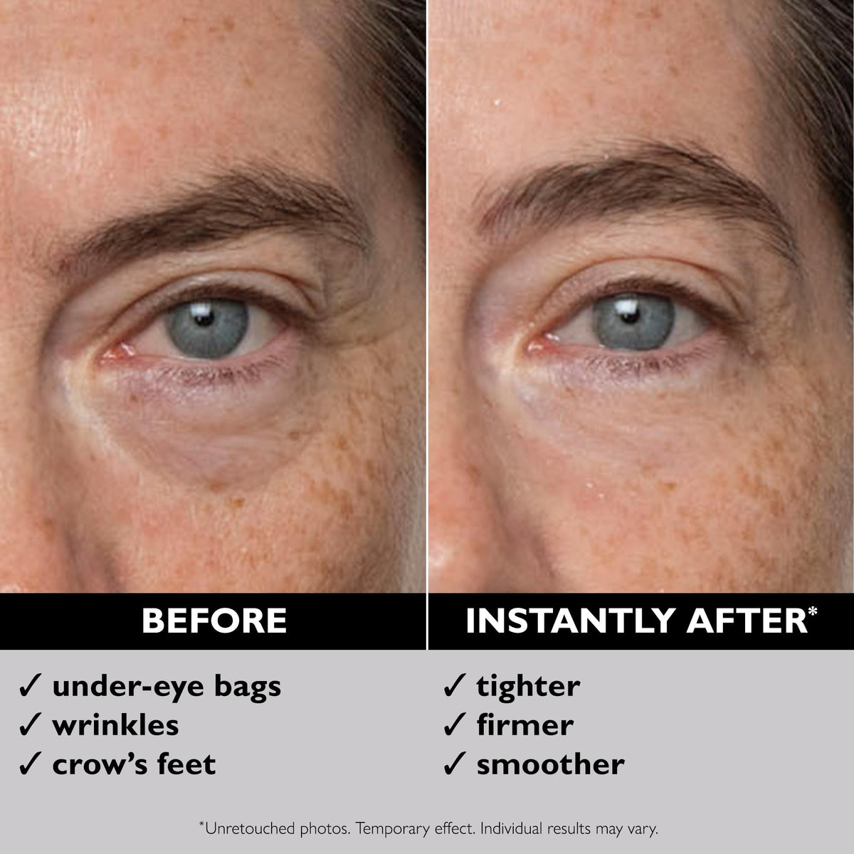 Peter Thomas Roth Instant FIRMx Eye - Temporary Eye Tightener for Instant De-Puffing & Smoothing