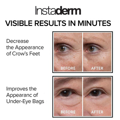 Instant Eye Tightener - Fast-Acting Under Eye Bag & Dark Circle Remover (15ml)