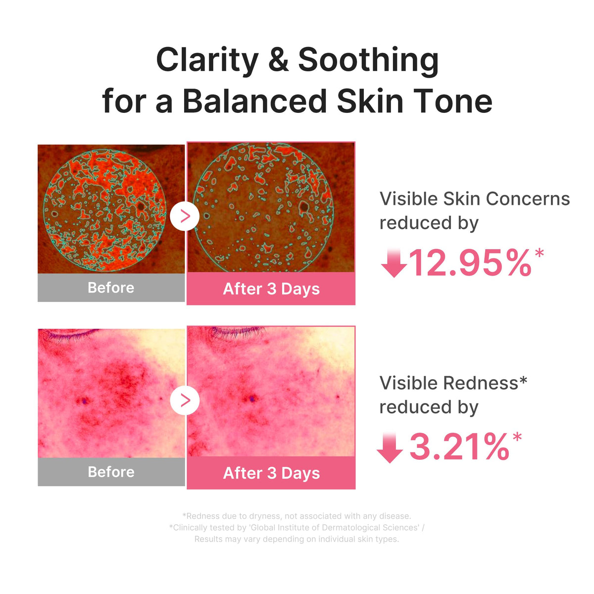 medicube PDRN Pink Peptide Serum with Salmon DNA - Ultra Light Hydrating Serum with Hyaluronic Acid - Fast-Absorbing Glow Care for Skin Clarity - Korean Skincare, 1.01 fl. Oz