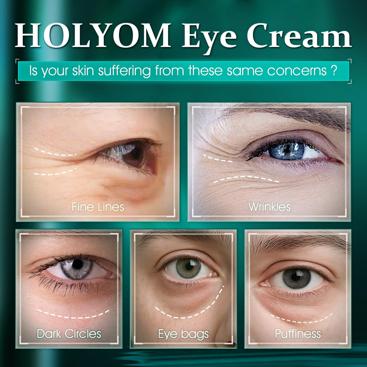HOLYOM Retinol Eye Cream - Rapid Anti-Aging & Tightening (1 fl oz)