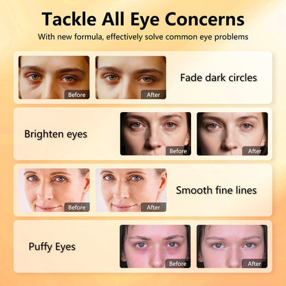 Aeryea Vitamin C & Caffeine Under Eye Patches - Brightening Hydra-Gel