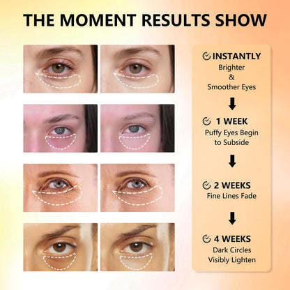 Aeryea Vitamin C & Caffeine Under Eye Patches - Brightening Hydra-Gel