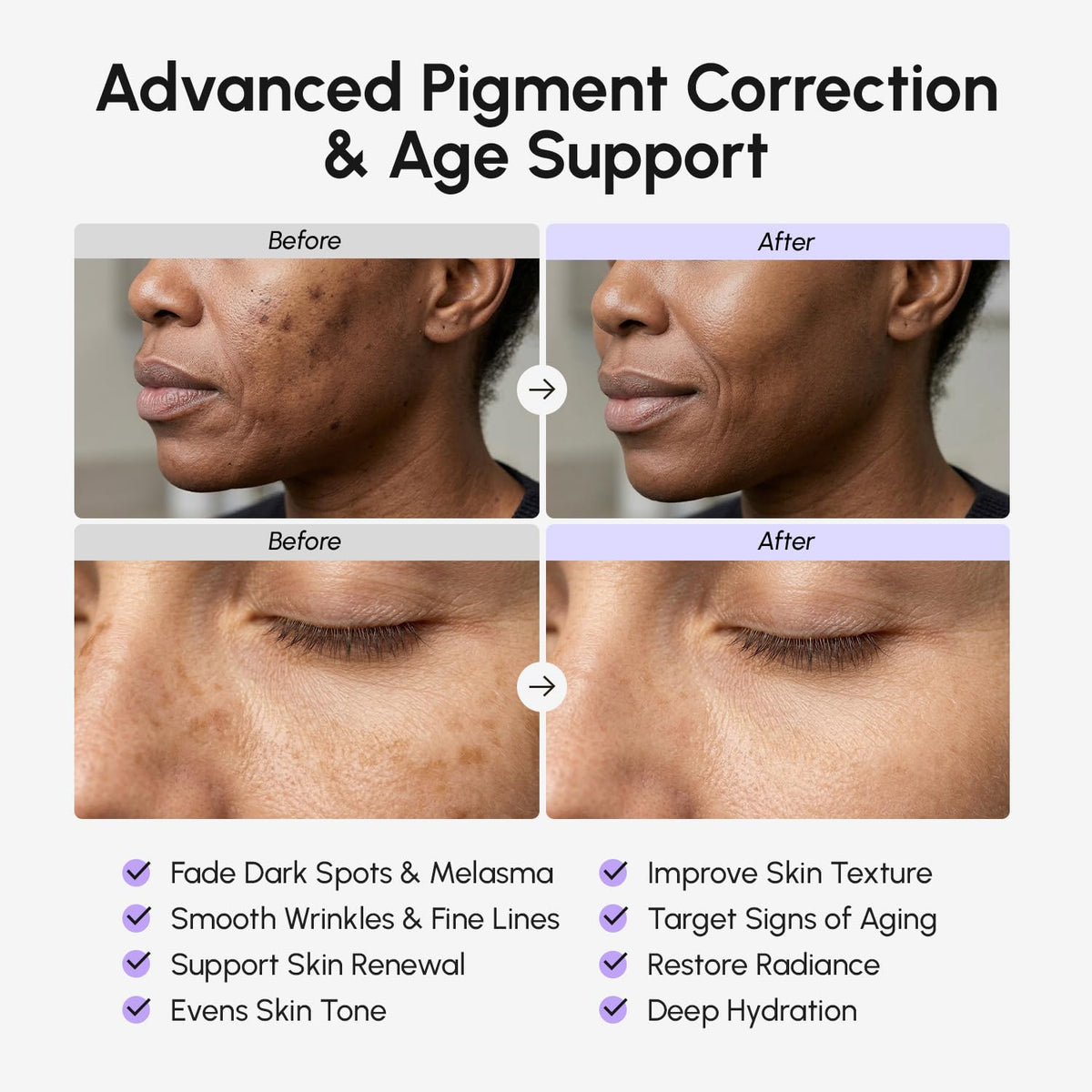 MAREE Tranexamic Acid Face Cream - Cream with Alpha Arbutin, Niacinamide, Peptide Complex & Vitamin C - Crema para las Manchas de la Cara