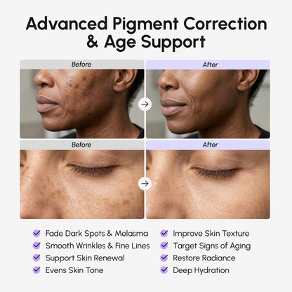 MAREE Tranexamic Acid Face Cream - Cream with Alpha Arbutin, Niacinamide, Peptide Complex & Vitamin C - Crema para las Manchas de la Cara