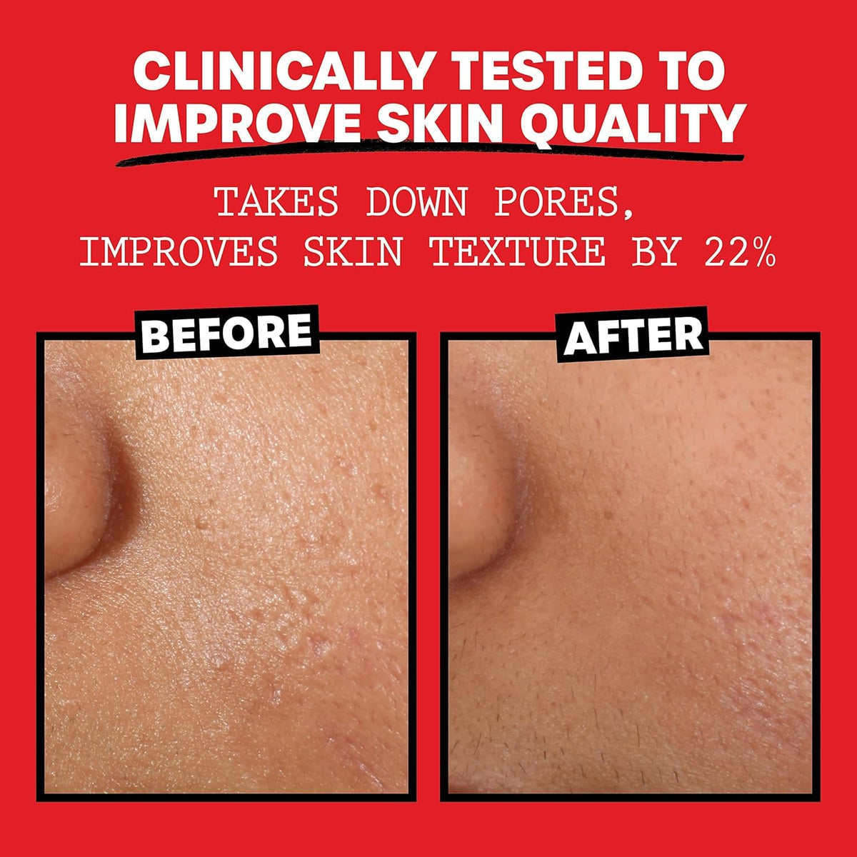 THAYERS Alcohol-Free, Hydrating, Unscented Witch Hazel Facial Toner with Aloe Vera Formula, Vegan, Dermatologist Tested and Recommended, 12 Oz (Pack of 2)