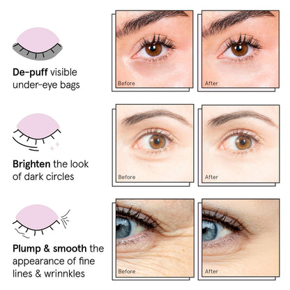 grace & stella Under Eye Mask - 12 Pairs - Vegan Gel Patches for Dark Circles & Puffiness